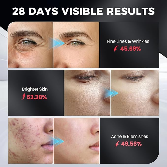Red Light Therapy for Face, LED 300 LEDs, 3 Modes, 10-Min Auto