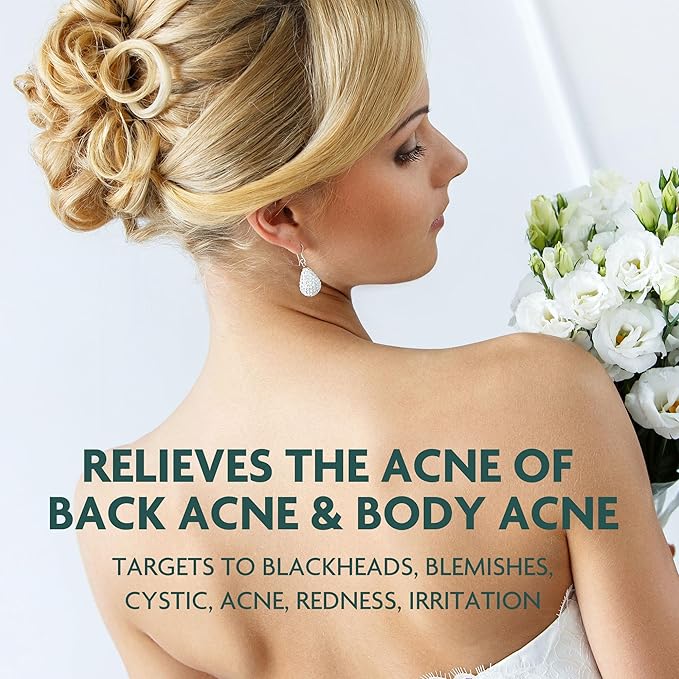 Back Acne Treatment, Back Acne Spray, 2% Salicylic