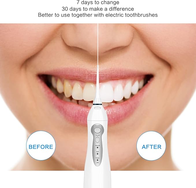 TOVENDOR Electric Water Flosser, Rechargeable Dental 3 Modes, 5 Tips (300ML, IPX7Waterproof IPX7Waterproof Waterflosser)