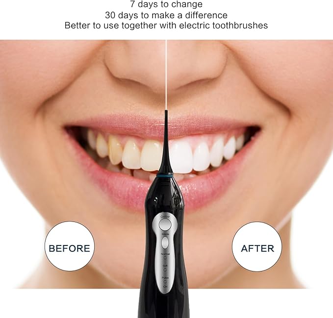 Electric Water Flosser, Rechargeable Dental Oral Irrigator 3 Modes, 5 Tips (300ML, IPX7Waterproof IPX7Waterproof Waterflosser)