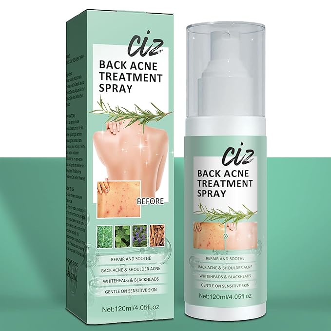 Back Acne Treatment, Back Acne Spray, 2% Salicylic