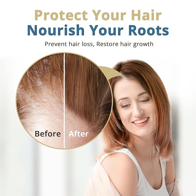 HAIRMETTO® Topical Saw Palmetto and Pumpkin Seed Oil Extract for Hair Loss, Strengthens Hair Roots, Soothes Dry Scalp, with Rosemary, Castor Oil, and Lavender Scent, 4oz Bottle
