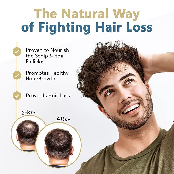 HAIRMETTO® Topical Saw Palmetto and Pumpkin Seed Oil Extract for Hair Loss, Strengthens Hair Roots, Soothes Dry Scalp, with Rosemary, Castor Oil, and Lavender Scent, 4oz Bottle